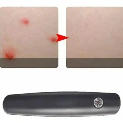 Skadedjur & Insekter-Klostillande penna, Myggbett, Lindring, Bett, Hjälppenna, Insekt, Klådstillande enhet, Insektsmedel--.pa